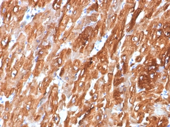 IHC staining of FFPE human heart tissue with Crystallin Alpha B antibody (clone CRYAB/7918). HIER: boil tissue sections in pH 9 10mM Tris with 1mM EDTA for 20 min and allow to cool before testing.