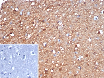 IHC staining of FFPE human brain tissue with Gamma Enolase antibody (clone ENO2/6678). Inset: PBS used in place of primary Ab (secondary Ab negative control). HIER: boil tissue sections in pH 9 10mM Tris with 1mM EDTA for 20 min and allow to cool before testing.