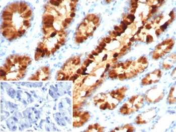 IHC staining of FFPE human stomach tissue with Estrogen Inducible Protein pS2 antibody (clone TFF1/7891). Inset: PBS used in place of primary Ab (secondary Ab negative control). HIER: boil tissue sections in pH 9 10mM Tris with 1mM EDTA for 20 min and allow to cool before testing.