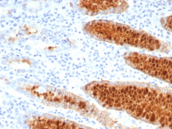IHC staining of FFPE human stomach tissue with Estrogen Inducible Protein pS2 antibody (clone TF/7770). HIER: boil tissue sections in pH 9 10mM Tris with 1mM EDTA for 20 min and allow to cool before testing.