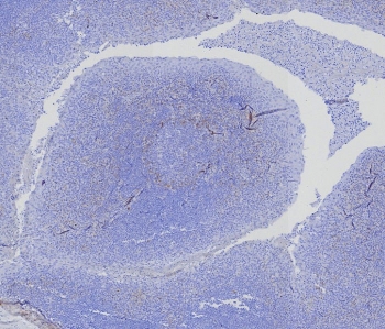 IHC staining of FFPE human tonsil tissue with recombinant BCMA antibody (clone CD269/8276R). HIER: boil tissue sections in pH 9 10mM Tris with 1mM EDTA for 20 min and allow to cool before testing.
