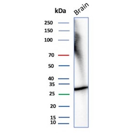 Western blot testing of human brain tissue lysate with recombinant CALB2 antibody. Predicted molecular weight ~29 kDa.