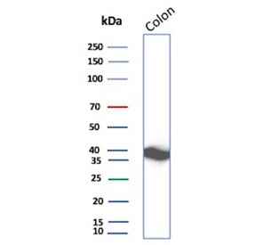 Western blot testing of human colon tissue lysate with CNN1 antibody. Predicted molecular weight ~34 kDa.