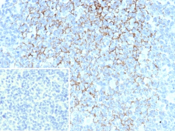 IHC staining of FFPE human tonsil. Membrane stained using FCER2/6893 at 2ug/ml. Inset: PBS used in place of primary Ab (secondary Ab negative control). HIER: boil tissue sections in pH 9 10mM Tris with 1mM EDTA for 20 min and allow to cool before testing.