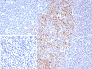 IHC staining of FFPE human tonsil tissue with CD23 antibody (clone FCER2/8511R). Inset: PBS used in place of primary Ab (secondary Ab negative control). HIER: boil tissue sections in pH 9 10mM Tris with 1mM EDTA for 20 min and allow to cool before testing.