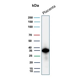 Western blot testing of human placental tissue lysate with EBI3 antibody (clone EBI3/8903). Predicted molecular weight ~25 kDa but may be observed at higher molecular weights due to glycosylation.