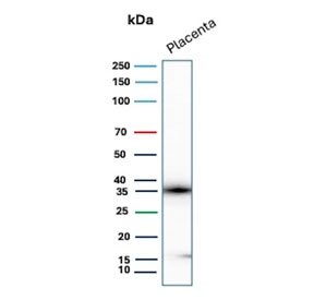 Western blot testing of human placental tissue lysate with Epstein-Barr virus induced 3 antibody (clone EBI3/8905). Predicted molecular weight ~25 kDa but may be observed at higher molecular weights due to glycosylation.