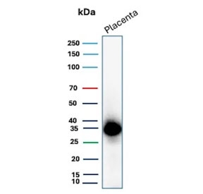 Western blot testing of human placental tissue lysate with EBI3 antibody (clone EBI3/8906). Predicted molecular weight ~25 kDa but may be observed at higher molecular weights due to glycosylation.
