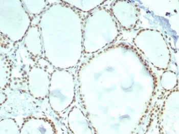 IHC staining of FFPE human thyroid tissue with ERCC1 antibody (clone ERCC1/7596). HIER: boil tissue sections in pH 9 10mM Tris with 1mM EDTA for 20 min and allow to cool before testing.