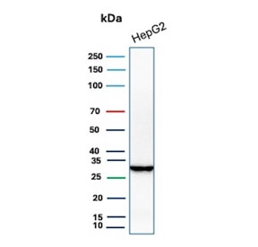 Western blot testing of human HepG2 cell lysate with Succinate dehydrogenase B antibody. Predicted molecular weight 25-32 kDa.
