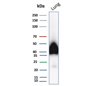 Western blot testing of human lung tissue lysate with Podoplanin antibody. Predicted molecular weight ~25 kDa but may be observed at higher molecular weights due to glycosylation.