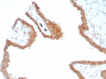 IHC staining of FFPE human prostate tissue with GLUL antibody (clone GLUL/8517R). HIER: boil tissue sections in pH 9 10mM Tris with 1mM EDTA for 20 min and allow to cool before testing.