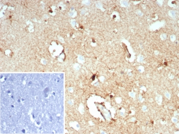 IHC staining of FFPE human brain tissue with GLUL antibody (clone GLUL/8619R). HIER: boil tissue sections in pH 9 10mM Tris with 1mM EDTA for 20 min and allow to cool before testing.