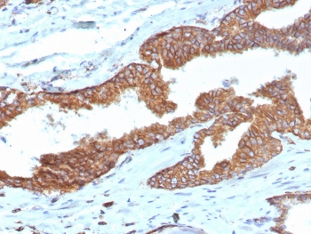 IHC staining of FFPE human prostate tissue with Cyclooxygenase 2 antibody (clone COX2/7803R). HIER: boil tissue sections in pH 9 10mM Tris with 1mM EDTA for 20 min and allow to cool before testing.