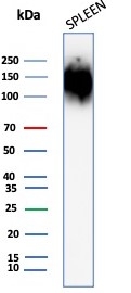 Western blot testing of human spleen tissue lysate with CD45 antibody (clone rPTPRC/1147). Expected molecular weight: 147-220 kDa depending on glycosylation level.