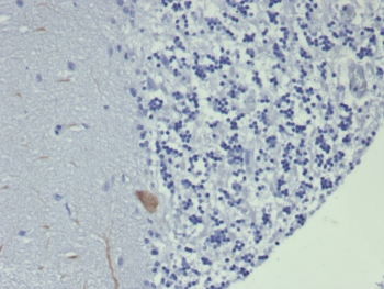 IHC staining of FFPE human brain tissue with GIRK2 antibody (clone KCNJ6/7559) at 2ug/ml. HIER: boil tissue sections in pH 9 10mM Tris with 1mM EDTA for 20 min and allow to cool before testing.