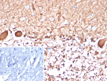 IHC staining of FFPE human brain tissue with S100B antibody (clone S100B/4148). Inset: PBS used in place of primary Ab (secondary Ab negative control). HIER: boil tissue sections in pH 9 10mM Tris with 1mM EDTA for 20 min and allow to cool before testing.