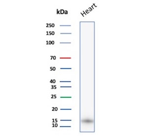 Western blot testing of human heart lysate with FABP3 antibody. Predicted molecular weight ~14 kDa.