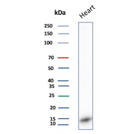 Western blot testing of human heart tissue lysate with FABP3 antibody. Predicted molecular weight ~14 kDa.