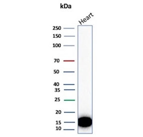 Western blot testing of different lots of human heart lysate with H-FABP antibody. Predicted molecular weight ~14 kDa.
