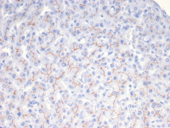 IHC staining of FFPE human liver tissue with BSEP antibody (clone BSEP/7534). HIER: boil tissue sections in pH 9 10mM Tris with 1mM EDTA for 20 min and allow to cool before testing.
