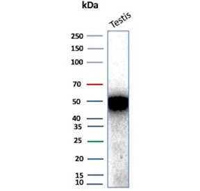 Western blot testing of human testis tissue lysate with Inhibin alpha antibody. Predicted molecular weight ~40 kDa but may be observed at higher molecular weights due to glycosylation.