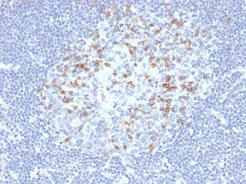 IHC staining of FFPE human lymph node tissue with PD1 (CD279) antibody (clone PDCD1/4231R). HIER: boil tissue sections in pH 9 10mM Tris with 1mM EDTA for 20 min and allow to cool before testing.