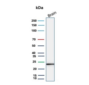 Western blot testing of human brain tissue lysate with UchL1 antibody. Predicted molecular weight ~25 kDa.