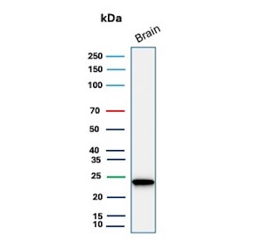 Western blot testing of human brain tissue lysate with UchL1 antibody. Predicted molecular weight ~25 kDa.