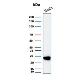 Western blot testing of human brain tissue lysate with PGP9.5 antibody. Predicted molecular weight ~25 kDa.