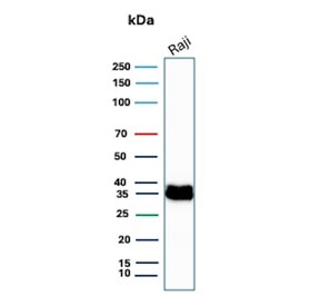 Western blot testing of human Raji cell lysate with CD74 antibody. Expected molecular weight: 33-43 kDa.