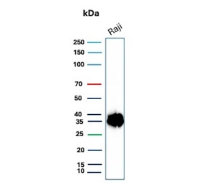 Western blot testing of human Raji cell lysate with CD74 antibody. Expected molecular weight: 33-43 kDa.