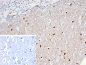 IHC staining of FFPE human brain tissue with SCGN antibody (clone SCGN/7326). Inset: PBS used in place of primary Ab (secondary Ab negative control). HIER: boil tissue sections in pH 9 10mM Tris with 1mM EDTA for 20 min and allow to cool before testing.