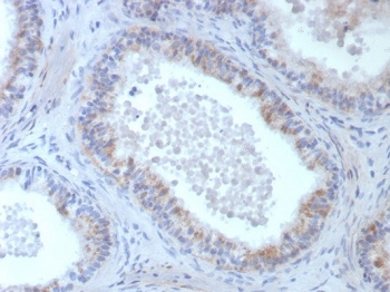 IHC staining of FFPE human epididymis tissue with ROS1 antibody (clone ROS1/8268R). HIER: boil tissue sections in pH 9 10mM Tris with 1mM EDTA for 20 min and allow to cool before testing.