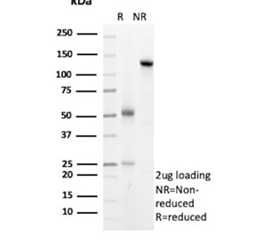 SDS-PAGE analysis of purified, BSA-free Arginase 1 antibody (clone ARG1/8869R) as confirmation of integrity and purity.