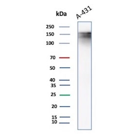 Western blot testing of A431 lysate using Epidermal Growth Factor Receptor antibody. Expected molecular weight: 134-180 kDa depending on glycosylation level.