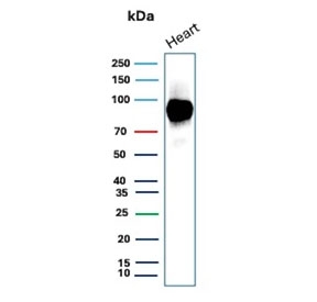 Western blot testing of human heart tissue lysate with CD36 antibody (clone CD36/7218). Expected molecular weight: 53-88 kDa depending on level of glycosylation.