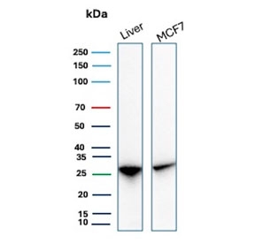 Western blot testing of human liver and MCF7 cell lysate with HSP27 / HSPB1 antibody (clone rHSPB1/7298). Predicted molecular weight: 23-27 kDa.