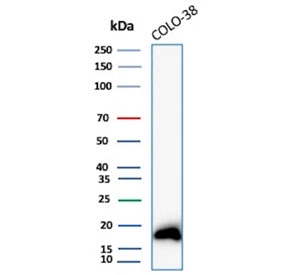 Western blot testing of human COLO-38 cell lysate with MART-1 antibody. Expected molecular weight ~20 kDa with possible doublet.