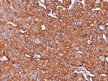 IHC staining of FFPE human adrenal tissue with Synaptophysin antibody (clone SYP/7976R). HIER: boil tissue sections in pH 9 10mM Tris with 1mM EDTA for 20 min and allow to cool before testing.