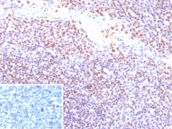 IHC staining of FFPE human tonsil tissue with recombinant EBV antibody (clone EBV/9620R). Inset: PBS used in place of primary Ab (secondary Ab negative control).