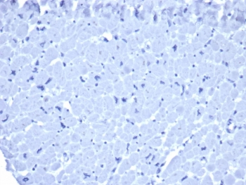 No staining was observed: IHC staining of FFPE human heart tissue with mouse IgG1 antibody (clone ICG1/ 1331). HIER: boil tissue sections in pH 9 10mM Tris with 1mM EDTA for 20 min and allow to cool before testing.