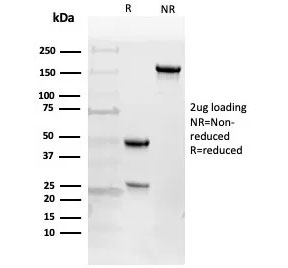 SDS-PAGE analysis of purified, BSA-free EGFR antibody (clone 225) as confirmation of integrity and purity.