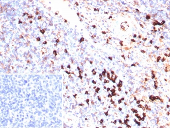 IHC staining of FFPE human tonsil tissue with recombinant Lambda Light Chain antibody (clone IGL/9397R). Inset: PBS used in place of primary Ab (secondary Ab negative control).