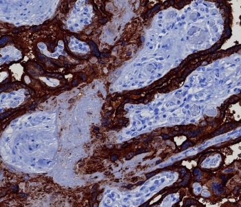 IHC staining of FFPE human placental tissue with recombinant PLAP antibody (clone ALPP/8112R). HIER: boil tissue sections in pH 9 10mM Tris with 1mM EDTA for 20 min and allow to cool before testing.