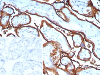 IHC staining of FFPE human tonsil tissue with recombinant ALPP antibody (clone ALPP/9109R). Inset: PBS used in place of primary Ab (secondary Ab negative control).