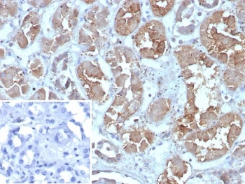 IHC staining of FFPE human kidney tissue with FABP1 antibody (clone FABP1/4462). HIER: boil tissue sections in pH 9 10mM Tris with 1mM EDTA for 20 min and allow to cool before testing.