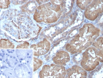 IHC staining of FFPE human kidney tissue with Fatty Acid Binding Protein 1 antibody (clone FABP1/4463). HIER: boil tissue sections in pH 9 10mM Tris with 1mM EDTA for 20 min and allow to cool before testing.