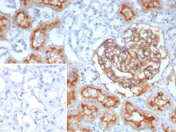 IHC staining of FFPE human prostate tissue with recombinant MME antibody (clone rMME/9377). Inset: PBS used in place of primary Ab (secondary Ab negative control). HIER: boil tissue sections in pH 9 10mM Tris with 1mM EDTA for 20 min and allow to cool before testing.