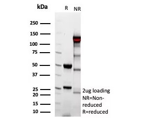 SDS-PAGE analysis of purified, BSA-free recombinant Complement 4d antibody (clone C4D/9213R) as confirmation of integrity and purity.